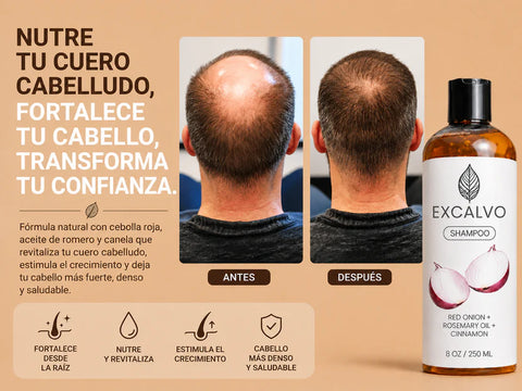 Image of SHAMPOO EXCALVO-FORTALECE Y ESTIMULA EL CRECIMIENTO DEL CABELLO